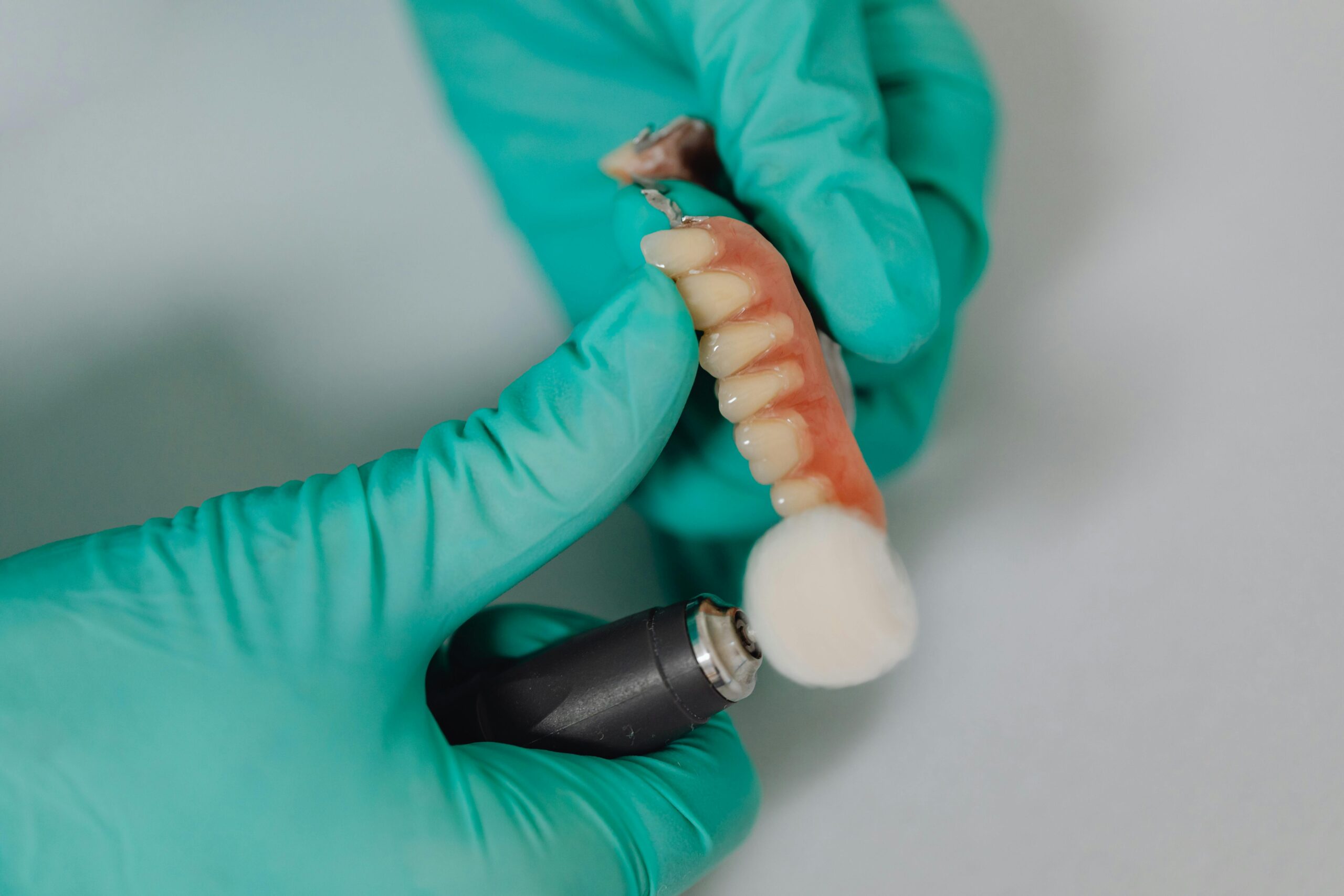 Implant Restoration