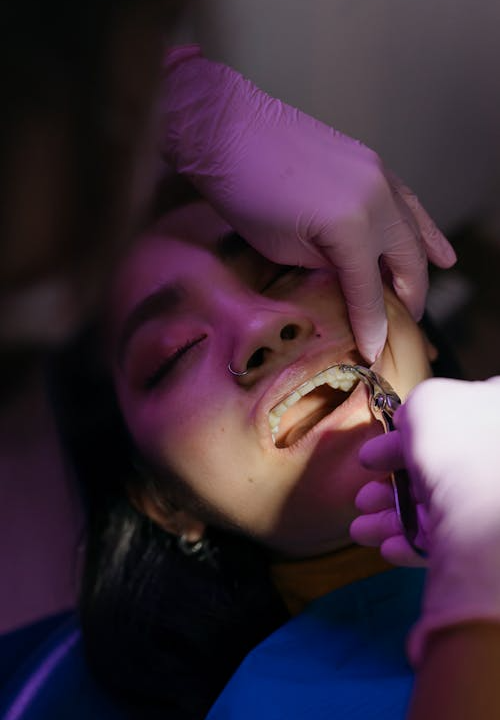 Modern dental clinic performing dental implant treatment in Vancouver with advanced technology.